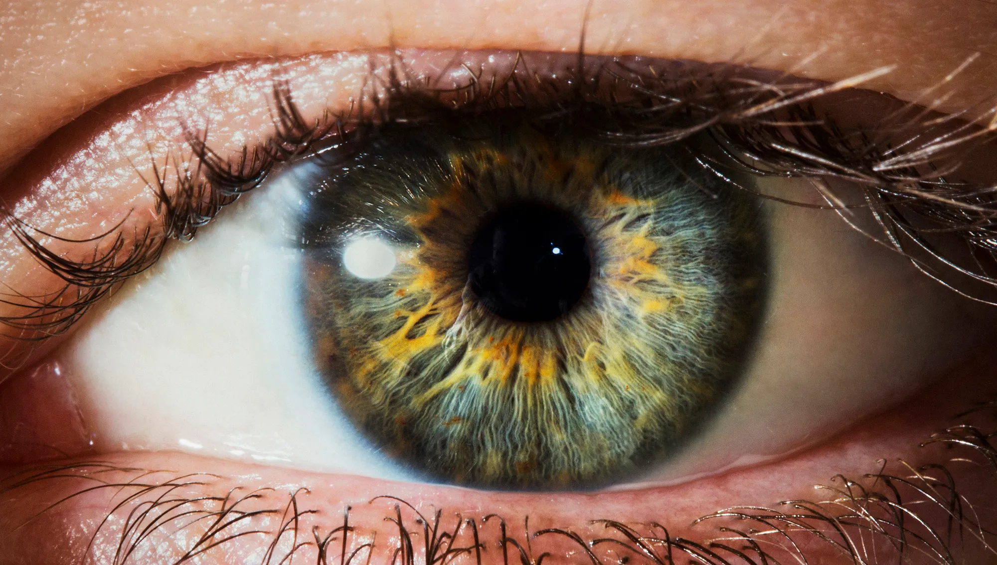 eyefacts-146599805-770x533-1-jpg