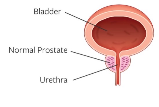 Normal Prostate Normal Prostate